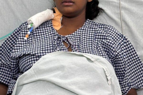 17 ఏళ్ల యువతికి అత్యవసర లివర్ మార్పిడి